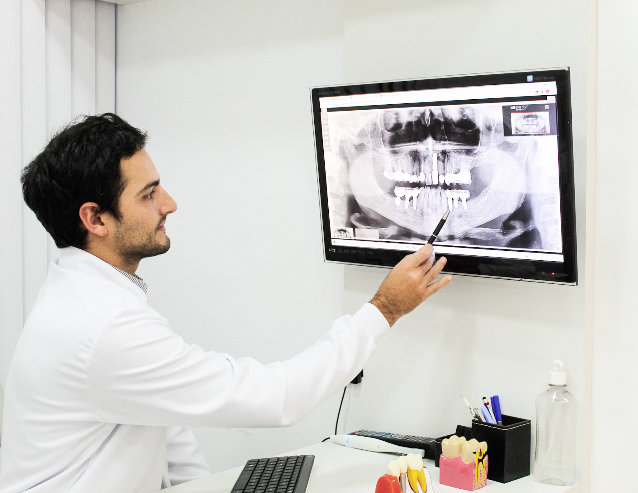 implante dental dr henrique pellegrini